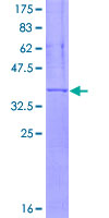12.5% SDS-PAGE Stained with Coomassie Blue